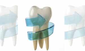 routine dental care- watford dental