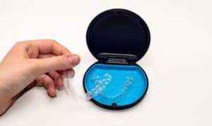 Invisalign treatment process: what to expect?