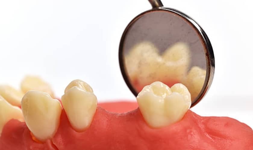 how to fix gap between crown and gum