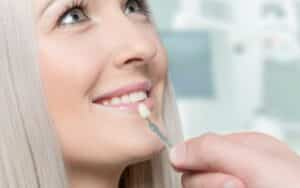 How Lumineers Can Change Your Smile Without Drilling