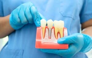 root canal and tooth extraction prices